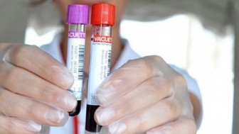 Hormon Kan Test Sonuçları