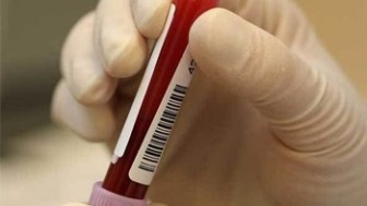 Lösemi Hemogram Testinde Ortaya Çıkar mı?